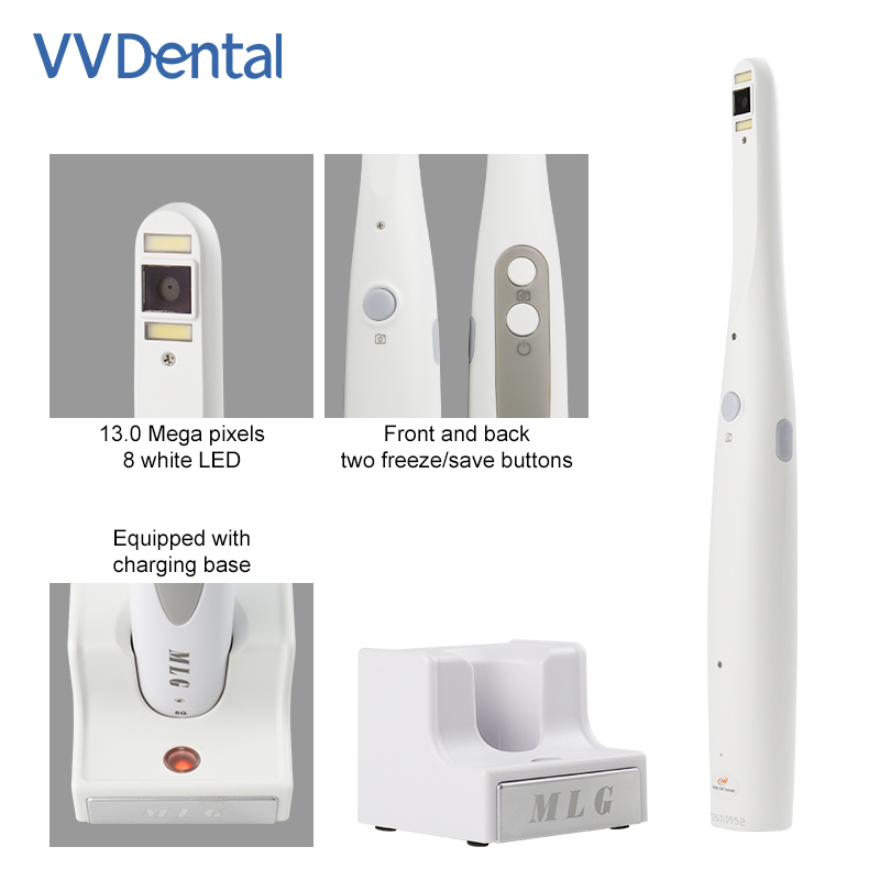 Kamera Intraoral Gigi Nirkabel - Photography Dental ulasan dan harga