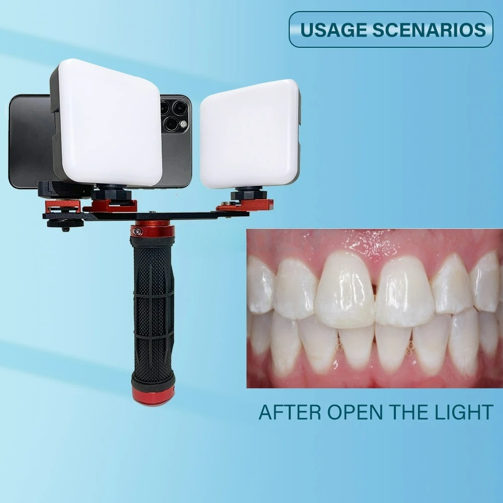 Lampu Fotografi Gigi untuk Pon - Photography Dental ulasan dan harga