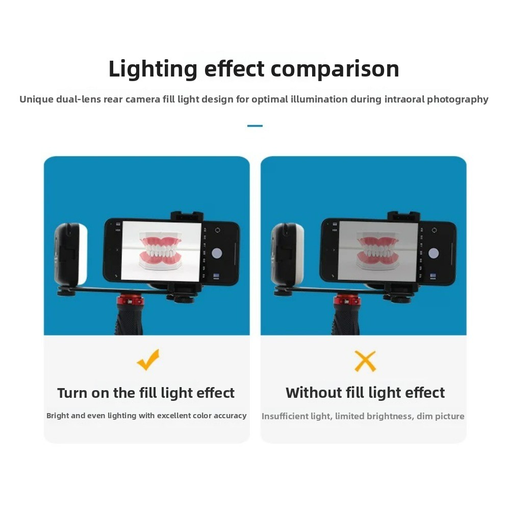 Lampu Fotografi Gigi, Flash LE - Photography Dental ulasan dan harga