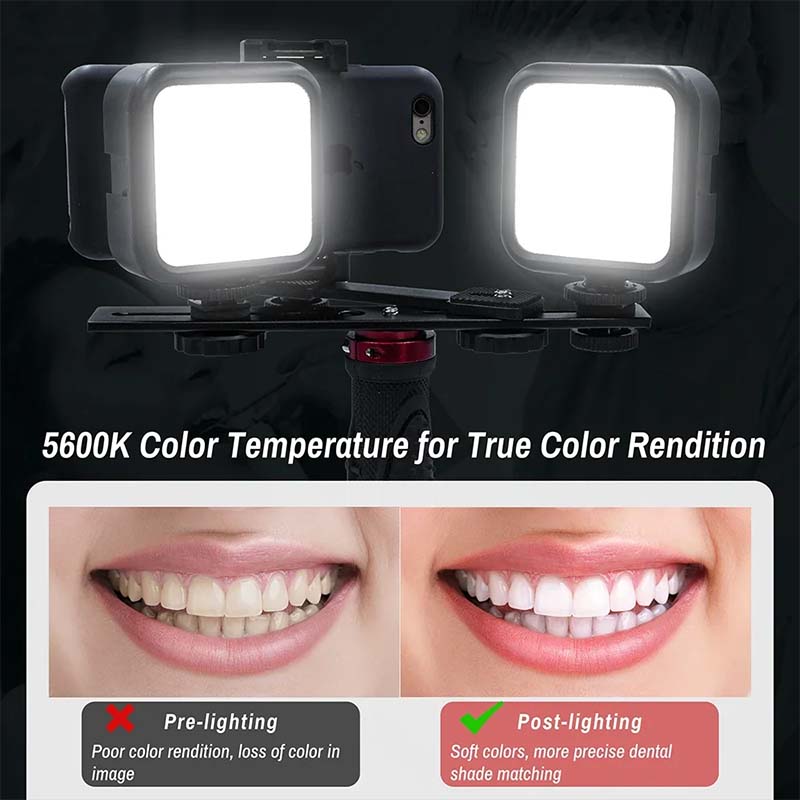 Lampu Fotografi Gigi Dengan Bl - Photography Dental ulasan dan harga